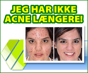 Derminax - acne